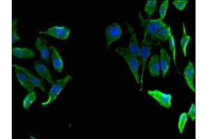 Immunofluorescent analysis of Hela cells using ABIN7153235 at dilution of 1:100 and Alexa Fluor 488-congugated AffiniPure Goat Anti-Rabbit IgG(H+L) (FAH antibody  (AA 2-250))