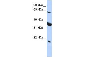 SRPR antibody used at 1 ug/ml to detect target protein. (SRPR antibody)
