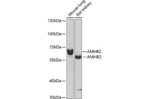 Western blot analysis of extracts of various cell lines, using  antibody  at 1:1000 dilution. (AMHR2 antibody  (AA 18-149))