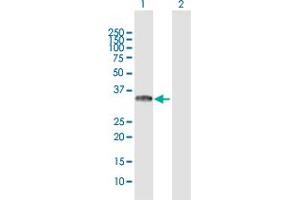 Western Blot analysis of TICAM2 expression in transfected 293T cell line by TICAM2 MaxPab polyclonal antibody. (TICAM2 antibody  (AA 1-235))