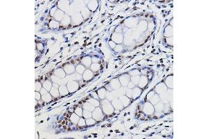 Immunohistochemistry of paraffin-embedded human colon using METTL14 Rabbit pAb (ABIN6131104, ABIN6143759, ABIN6143760 and ABIN6224625) at dilution of 1:100 (40x lens). (METTL14 antibody  (AA 1-210))