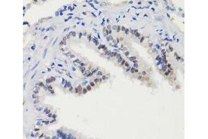 Immunohistochemistry of paraffin-embedded Rat lung using Phospho-Stat3(S727) Polyclonal Antibody at dilution of 1:100 (40x lens).