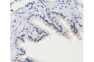 Immunohistochemistry of paraffin-embedded Rat lung using Phospho-Stat3(S727) Polyclonal Antibody at dilution of 1:100 (40x lens). (STAT3 antibody  (pSer727))