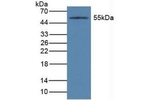 Detection of CYP1A1 in Mouse Liver Tissue using Polyclonal Antibody to Cytochrome P450 1A1 (CYP1A1) (CYP1A1 antibody  (AA 1-250))