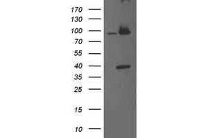 HEK293T cells were transfected with the pCMV6-ENTRY control (Left lane) or pCMV6-ENTRY PSMD2 (Right lane) cDNA for 48 hrs and lysed. (PSMD2 antibody)