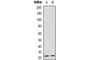 Western blot analysis of Recoverin expression in Y79 (A), NIH3T3 (B) whole cell lysates. (Recoverin antibody)