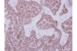 Image no. 1 for anti-Dihydrouridine Synthase 2-Like (DUS2L) (AA 1-199) antibody (ABIN1497929) (DUSL2 antibody  (AA 1-199))