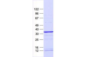 Validation with Western Blot (EHF Protein (His tag))
