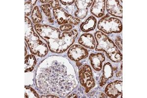 Immunohistochemical staining (Formalin-fixed paraffin-embedded sections) of human kidney with CDC16 polyclonal antibody  shows strong cytoplasmic positivity in cells in tubules.