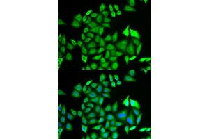 Immunofluorescence analysis of U2OS cell using PSMA3 antibody. (PSMA3 antibody)