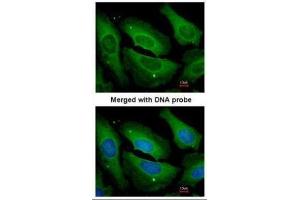 ICC/IF Image Immunofluorescence analysis of paraformaldehyde-fixed HeLa, using PP1 gamma, antibody at 1:200 dilution. (PPP1CC antibody  (Center))