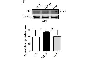 Slug is regulated by the co-transcriptional complex YAP1/TEAD in the EMT program of A549 cells. (GAPDH antibody)