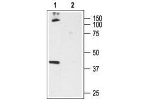 Western blot analysis of rat brain membrane proteins: - 1. (CNR1 antibody  (Extracellular, N-Term))