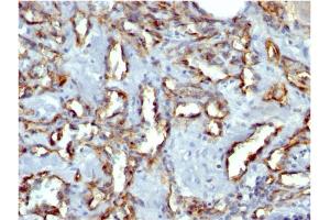 Immunohistochemistry (IHC) image for anti-Platelet/endothelial Cell Adhesion Molecule (PECAM1) antibody (ABIN6940280)