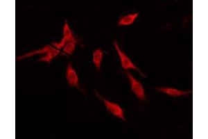 ABIN6274844 staining NIH-3T3 by IF/ICC. (ALS2CR11 antibody)