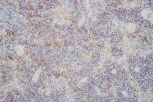 Immunohistochemistry (IHC) image for anti-V-Rel Reticuloendotheliosis Viral Oncogene Homolog B (RELB) antibody (ABIN5961881) (RELB antibody)