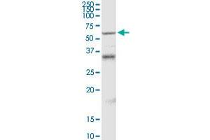 MDM4 MaxPab rabbit polyclonal antibody. (MDM4-binding Protein antibody  (AA 1-490))