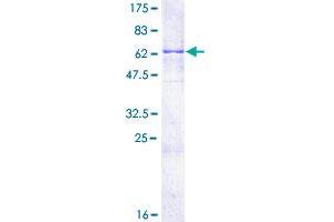 Image no. 1 for Protein Kinase C, delta Binding Protein (PRKCDBP) (AA 1-261) protein (GST tag) (ABIN1316261) (PRKCDBP Protein (AA 1-261) (GST tag))