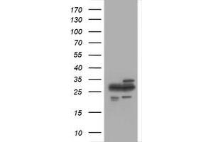 Image no. 1 for anti-Proteasome Subunit alpha 2 (PSMA2) (AA 50-234) antibody (ABIN1491569) (PSMA2 antibody  (AA 50-234))