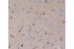 Used in DAB staining on fromalin fixed paraffin- embedded brain tissue (CHRNA10 antibody  (AA 25-425))
