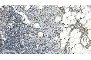 IHC analysis of FLCN using anti-FLCN antibody (ABIN7602491).