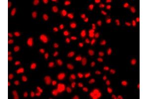 PRICKLE2 antibody  (AA 615-844)