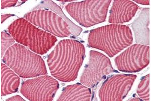 Human Skeletal Muscle (formalin-fixed, paraffin-embedded) stained with TBC1D4 antibody ABIN351486 at 3. (TBC1D4 antibody  (AA 825-837))