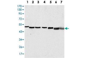 Western blot analysis using TP63 monoclonal antobody, clone 4E5  against A-431 (1), HeLa (2), Jurkat (3), THP-1 (4), NIH/3T3 (5), COS-7 (6) and PC-12 (7) cell lysate. (p63 antibody)