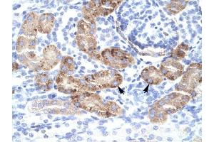 DMRTA2 antibody was used for immunohistochemistry at a concentration of 4-8 ug/ml to stain Epithelial cells of renal tubule (lndicated with Arrows) in Human Kidney. (DMRTA2 antibody  (C-Term))