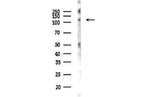 Western blot analysis of lysates from MCF7 cells, using Phospho-SIK2 (Thr484) Antibody at 1/1000 dilution.