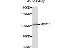 Western blot analysis of extracts of mouse kidney, using MEP1B antibody (ABIN6003791) at 1/1000 dilution.