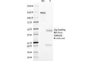 SDS-PAGE Analysis Purified Erythrocyte Specific Mouse Monoclonal Antibody (SFL23. (Erythrocyte Specific Antigen antibody)