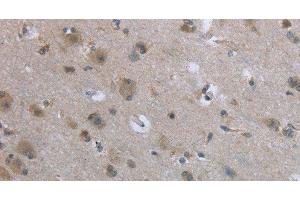 Immunohistochemistry of paraffin-embedded Human brain tissue using EGFL8 Polyclonal Antibody at dilution 1:40