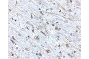 Immunohistochemistry of FKBP15 in mouse brain tissue with FKBP15 antibody at 2.