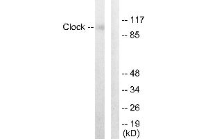 Immunohistochemistry analysis of paraffin-embedded human skeletal muscle tissue using Clock antibody. (CLOCK antibody  (Internal Region))