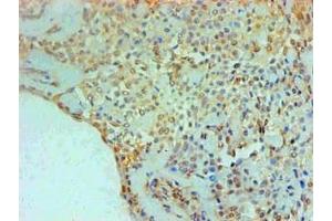 Immunohistochemical of paraffin-embedded Human Breast tissue using ABIN7166415 at dilution of 1:200. (Transglutaminase 2 antibody)