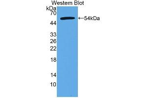 Detection of Recombinant CTRB2, Human using Polyclonal Antibody to Chymotrypsinogen B2 (CTRB2) (CTRB2 antibody  (AA 34-263))