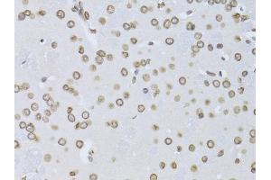Immunohistochemistry of paraffin-embedded mouse brain using LMNB2 Antibody (ABIN5973877) at dilution of 1/100 (40x lens). (Lamin B2 antibody)