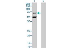 Western Blot analysis of ZNF182 expression in transfected 293T cell line by ZNF182 MaxPab polyclonal antibody. (ZNF182 antibody  (AA 1-620))