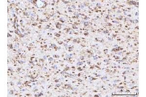 IHC analysis of RBP1 using anti-RBP1 antibody (ABIN7599586). (RBP1 antibody  (AA 10-135))