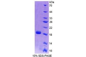 SDS-PAGE (SDS) image for Fumarate Hydratase (FH) (AA 42-185) protein (His tag) (ABIN6238927)