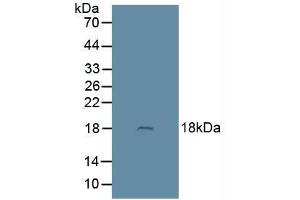 Figure. (Adrenomedullin antibody  (AA 22-147))