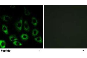 Immunofluorescence analysis of A-549 cells, using MBTPS2 polyclonal antibody . (MBTPS2 antibody)