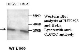 Image no. 1 for anti-Cyclin-Dependent Kinase Inhibitor 2C (p18, Inhibits CDK4) (CDKN2C) antibody (ABIN1575551)