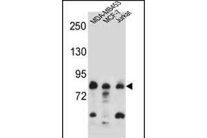 AFG3L2 Antibody (N-term) (ABIN657143 and ABIN2846279) western blot analysis in MDA-M,MCF-7,Jurkat cell line lysates (35 μg/lane). (AFG3L2 antibody  (N-Term))