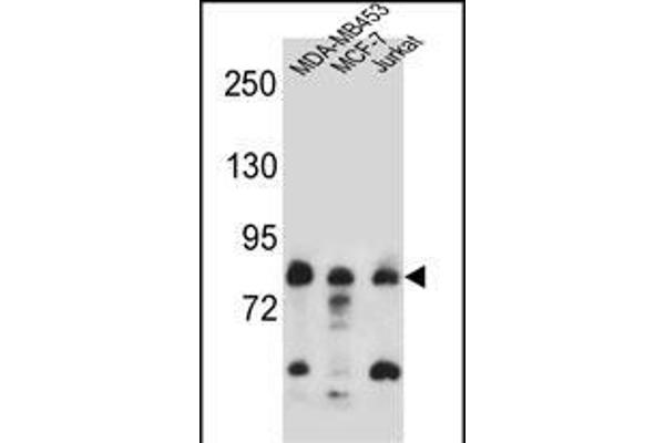 AFG3L2 Antikörper  (N-Term)