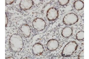 Immunoperoxidase of monoclonal antibody to CHEK2 on formalin-fixed paraffin-embedded human colon. (CHEK2 antibody  (AA 1-543))