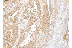 Immunohistochemistry (IHC) image for anti-NF-KappaB2 (/p52) (AA 1-50) antibody (ABIN7795782) (Recombinant NF-KappaB2 (/p52) (AA 1-50) antibody)