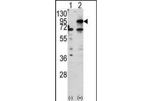 Western blot analysis of CPT1B (arrow) using rabbit polyclonal CPT1B Antibody (C-term) (ABIN389106 and ABIN2839296). (CPT1B antibody  (C-Term))