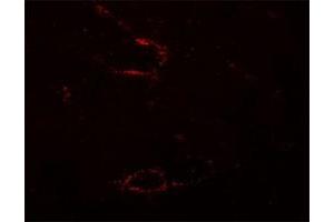 Immunofluorescencent staining of mouse skeletal muscle cells with SYNPO2L polyclonal antibody  at 5 ug/mL.